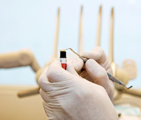 A dentist handling composite dental resin