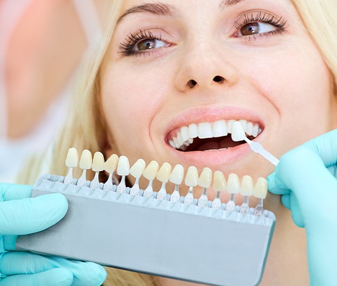 Woman's smile compared with porcelain veneers