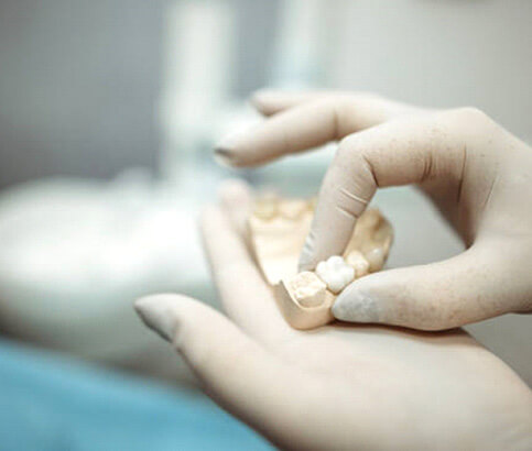 gloved hands holding crown and dental molds
