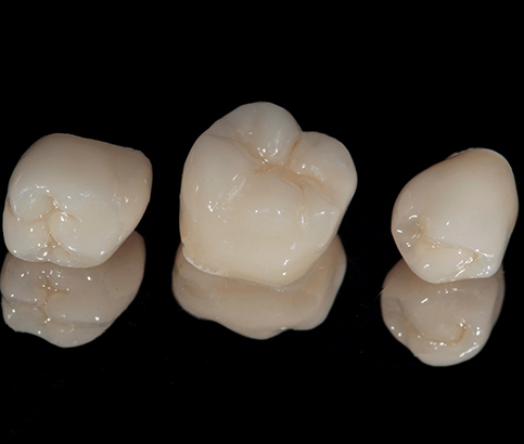 Three dental crowns in Reno, NV on a black reflective table
