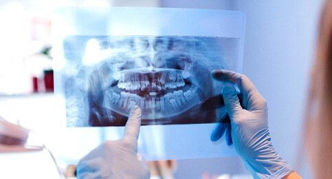 dentist looking at patients xrays