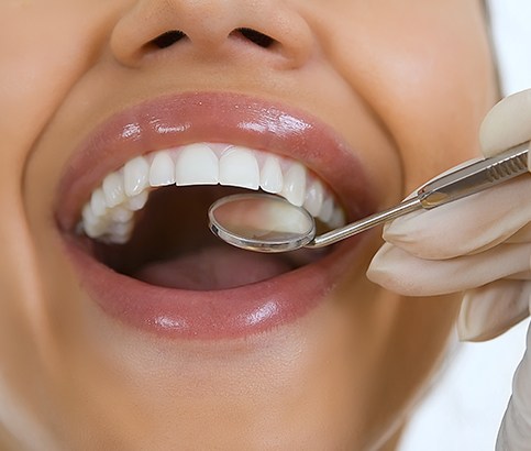 Dentist checking patient's smile after tooth colored filling restorative dentistry